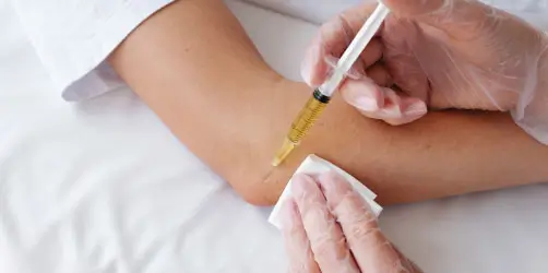 Platelet-Rich-Plasma_2025