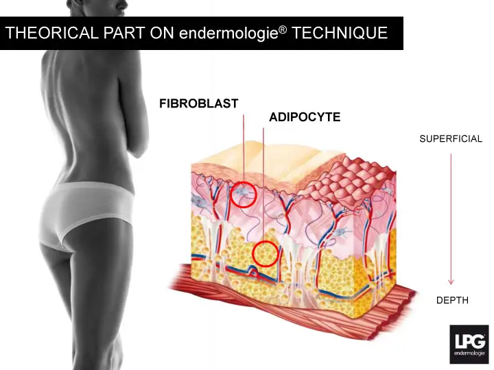 Endermology